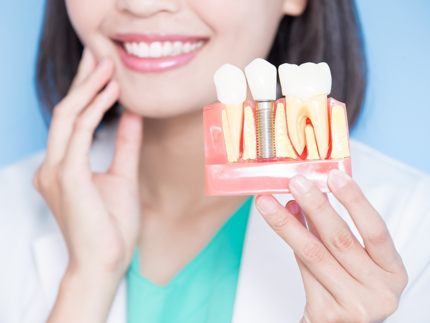 White or Composite Fillings at Bella Sonrisa Dental